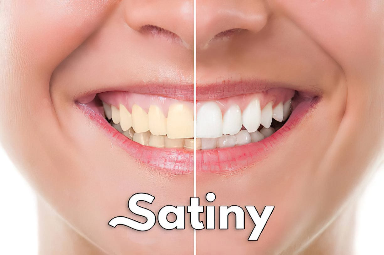 Lively® Cosmétiques & Soins Stylo blanchissant extrême | Lively®